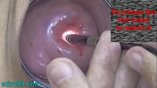 สุดยอด Endoscopic Camera in Cervix watch inside my Womb and Vagina. Inspection testing exam of wife by extreme doctor gynecologist คลิป ภาพยนตร์